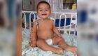 Contra tumor maligno na coluna, beb&ecirc; precisa de exame para evitar crescimento do c&acirc;ncer
