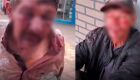 Idosos s&atilde;o espancados e socorridos com v&aacute;rios ferimentos em MS