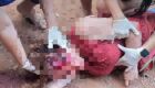 Mulher agredida com marreta pelo marido segue em estado grave em MS