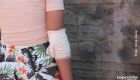 Adolescente quase tem bra&ccedil;o quebrado pelo pai durante festa  