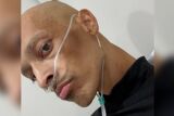 DJ enfrenta c&acirc;ncer pela segunda vez e faz campanha para custear transplante 