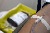 Hemosul alerta para baixo estoque de sangue O+ e convoca doadores em MS