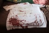Homem baleado na cabe&ccedil;a em MS morre no Hospital  