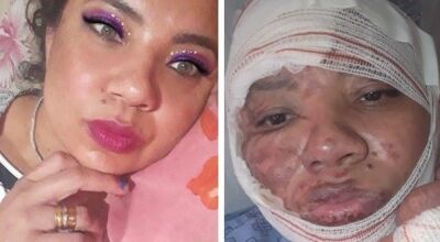 Cantor sertanejo, esposa e cunhada ficam feridos ap&oacute;s acidente com bife na chapa