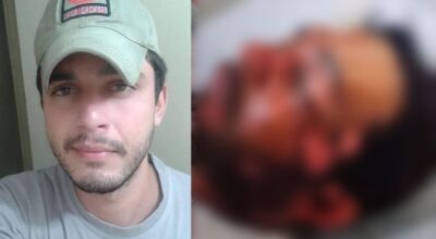 Homem atacado com água fervente pode perder a visão de um olho