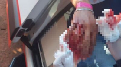 Jovem é socorrido com mão toda ensanguentada ao ser esfaqueado em MS