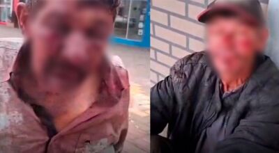 Idosos s&atilde;o espancados e socorridos com v&aacute;rios ferimentos em MS