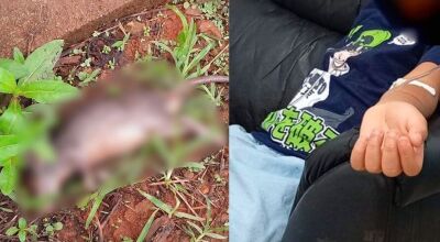 Crian&ccedil;a de 7 anos &eacute; mordida por rato de terreno abandonado