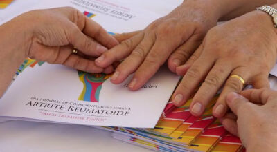 Novo medicamento para artrite reumatoide é incorporado ao SUS