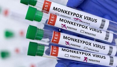 Douradense contaminado com 'varíola dos macacos' viajou para o Paraguai recentemente