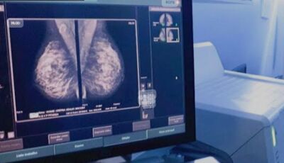 Conheça o exame de mamografia digital, do Bonito Imagem Diagnóstico. 
