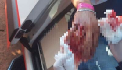 Jovem é socorrido com mão toda ensanguentada ao ser esfaqueado em MS