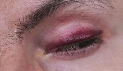 Homem é enforcado pelo próprio irmão por ciúmes da mãe em MS