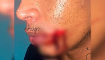 Patrão dá facada na boca de servente de pedreiro em MS