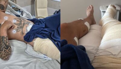 'Me puxou para terminar de me matar', diz vítima de 14 facadas em MS