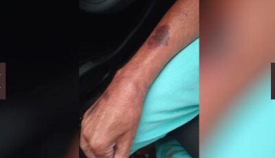 Adolescente agride a mãe em condomínio de luxo e foge  