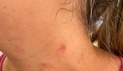 Homem tenta matar ex-mulher e amigo dela a facadas  