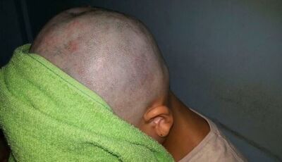 Mulher é agredida e tem cabelos cortados com faca pelo marido 