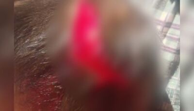 Enteado é preso ao dar facada na cabeça de padrasto