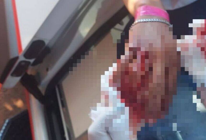 A Polícia Militar também foi acionada para comparecer ao local dos fatos e coletar detalhes sobre o caso