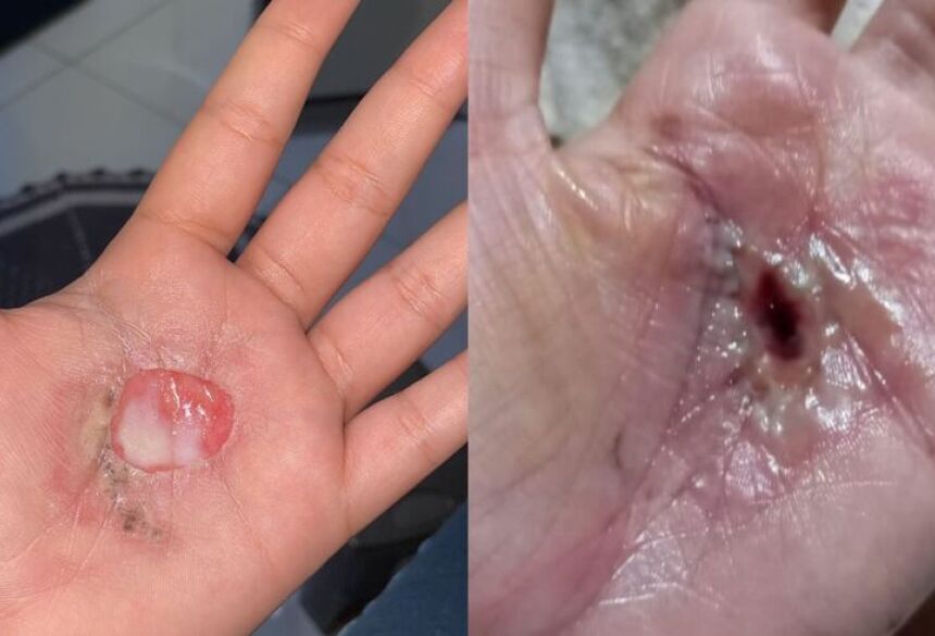 Ainda de acordo com o relato, o pai de santo alegou posteriormente que não se lembrava de nada, pois estaria incorporado durante o ritual