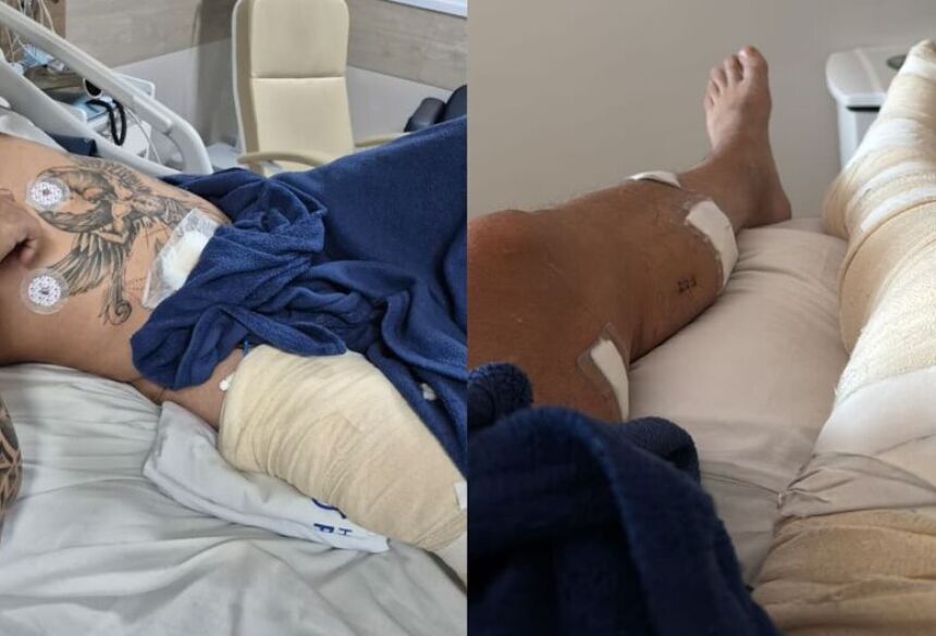 Empresário de 42 anos foi atacado pelo vizinho após pedir para ele tirar a caminhonete da frente de casa em Campo Grande 