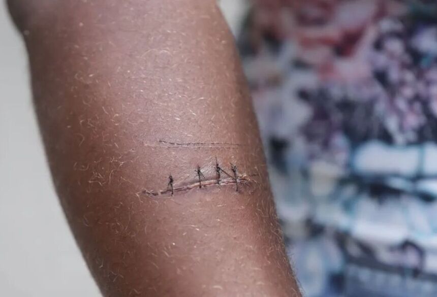 O jovem foi encaminhado à Santa Casa pela própria mãe para a realização de exames mais detalhados