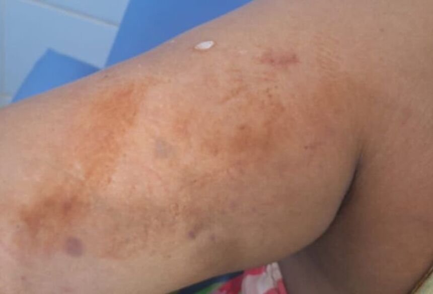 Após o homem ir embora, o suspeito, armado com uma faca, atacou a mulher. Em seguida, tentou atingi-la com golpes de martelo
