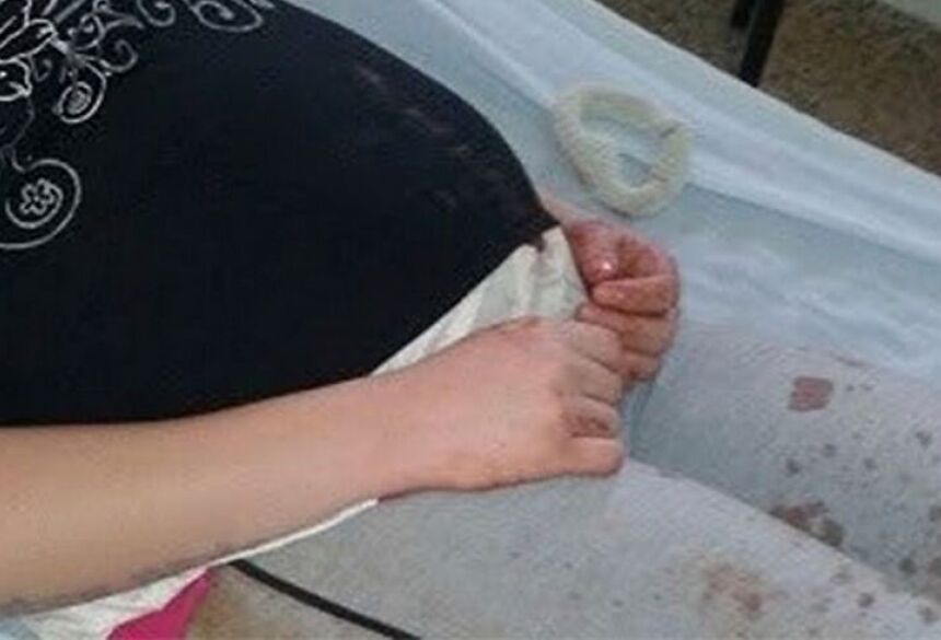 O objeto atingiu diretamente o olho direito da gestante