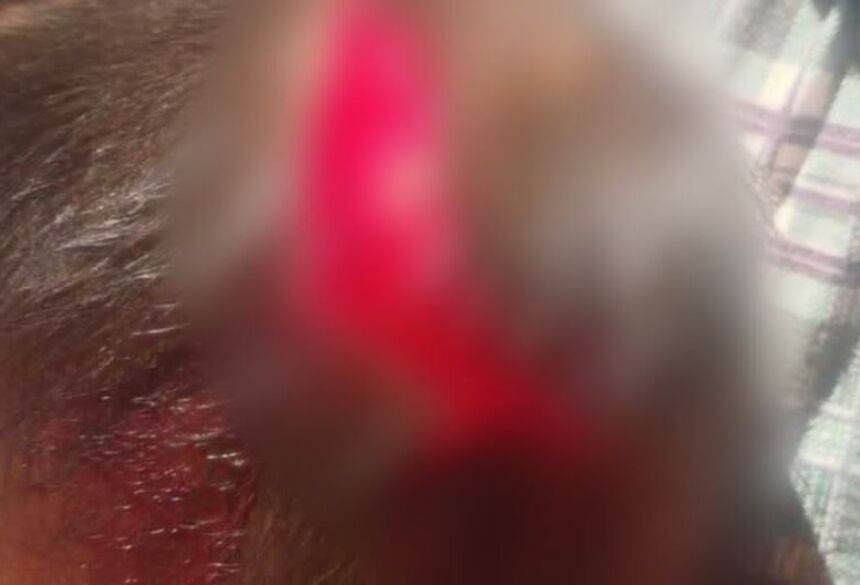 O caso foi registrado como lesão corporal leve porque, apesar do susto, a vítima estava consciente e orientada, sendo atendida e sem risco de morte